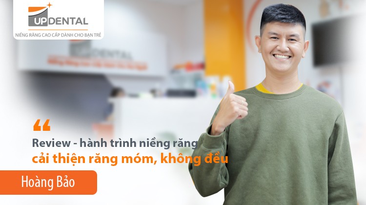 Hoàng Bảo và hành trình niềng răng cải thiện răng móm, không đều