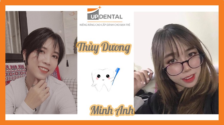 Kết quả sau 2 năm niềng răng của Thùy Dương và Minh Anh