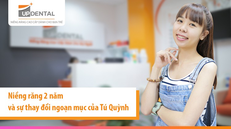 Niềng răng 2 năm và sự thay đổi ngoạn mục của Tú Quỳnh (25 tuổi)