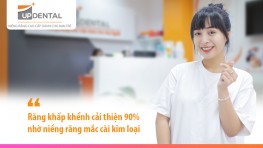 Răng khấp khểnh thay đổi nhờ niềng răng mắc cài kim loại