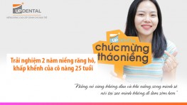 Trải nghiệm 2 năm niềng răng hô của cô nàng 25 tuổi