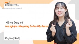Hồng Duy và trải nghiệm niềng răng 2 năm ở Up Dental