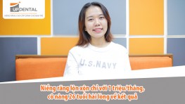 Niềng răng lộn xộn chỉ với 1 triệu/tháng, cô nàng 26 tuổi hài lòng về kết quả