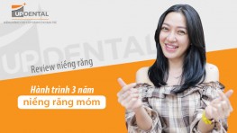 Hành trình 3 năm niềng răng móm - Huỳnh Giao