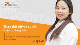 Thay đổi 90% sau khi niềng răng hô - Review của Ro Ky Giah