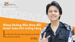 Răng không đều thay đổi hoàn toàn khi niềng răng (Lê Duy)