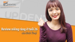 Review niềng răng ở tuổi 26 của Bích Thuỷ