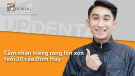Cảm nhận niềng răng lộn xộn tuổi 20 của Đình Huy