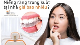 Niềng răng trong suốt giá bao nhiêu [11/2024] tại Up Dental