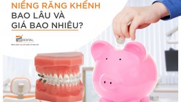 Niềng răng khểnh có nên không? Giá bao nhiêu [2024]?