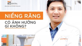 Niềng răng có ảnh hưởng gì không? Các vấn đề thường gặp