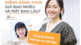 Niềng răng thưa bằng phương pháp nào? Có hiệu quả không?