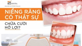 Niềng răng có hết hở lợi không?