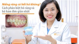 [Giải đáp thắc mắc] Hô hàm có niềng răng được không?