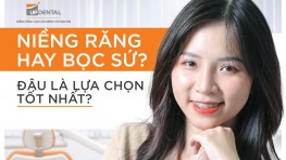 [Giải đáp] Nên niềng răng hay bọc sứ?