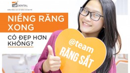 Niềng răng xong có đẹp không? Review của khách hàng