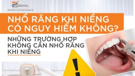 Niềng răng có phải nhổ răng không? Nhổ bao nhiêu răng?