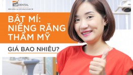 04 phương pháp niềng răng thẩm mỹ hiện nay