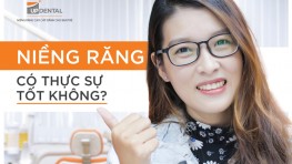 Niềng răng có tốt không? 5 lợi ích của niềng răng