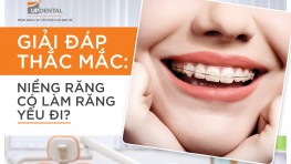 [Giải đáp thắc mắc] Niềng răng có làm răng yếu đi không?