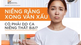 Niềng răng xong vẫn xấu nguyên nhân do đâu?