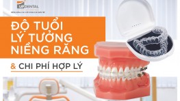 Khi nào cần niềng răng, độ tuổi lý tưởng và chi phí niềng