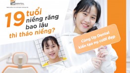 19 tuổi có niềng răng được không? Bao lâu tháo niềng?