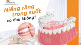 [Giải đáp thắc mắc] Niềng răng trong suốt có đau không?