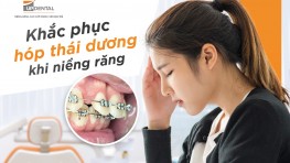 Hóp thái dương khi niềng răng - Nguyên nhân và cách khắc phục