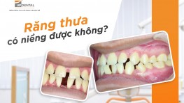 [Thắc mắc] Răng quá thưa có niềng được không?