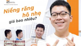 [Giải đáp thắc mắc] Răng hô nhẹ có nên niềng không?