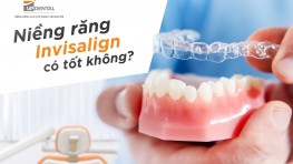 Niềng răng Invisalign có tốt không? Đánh giá hiệu quả