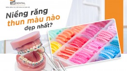 [Thắc mắc] Niềng răng thun màu nào đẹp nhất?