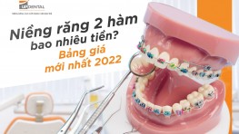 Giá niềng răng 2 hàm bao nhiêu? Bảng giá mới nhất 