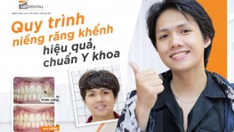 Quy trình niềng răng khểnh chuẩn Y khoa tại Up Dental