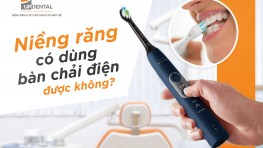 Top 11 bàn chải điện cho người niềng răng tốt nhất