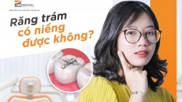 Răng trám có niềng được không? Giải đáp từ Bác sĩ Up Dental