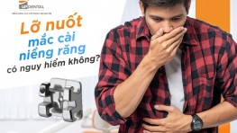 Lỡ nuốt mắc cài niềng răng có nguy hiểm không?