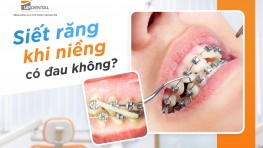 [Giải đáp thắc mắc] Siết răng khi niềng có đau không?