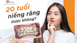 [Hỏi đáp] 20 tuổi có niềng răng được không? 