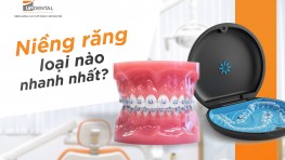 [Giải đáp thắc mắc] Niềng răng loại nào nhanh nhất?