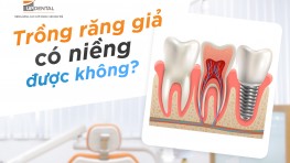 [Giải đáp thắc mắc] Trồng răng giả có niềng được không?