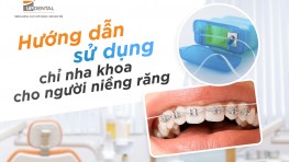 Hướng dẫn sử dụng chỉ nha khoa cho người niềng răng