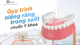 Quy trình niềng răng trong suốt chuẩn Y khoa mới nhất