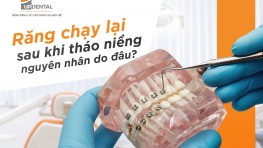 Răng chạy lại sau khi tháo niềng nguyên nhân do đâu?