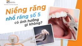 Nhổ răng số 5 để niềng răng có ảnh hưởng gì không?