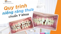 Quy trình niềng răng thưa chuẩn Y khoa tại Up Dental