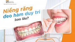 [Giải đáp thắc mắc] Niềng răng xong phải đeo hàm duy trì bao lâu?