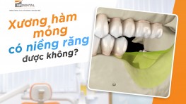 [Giải đáp] Xương hàm mỏng có niềng răng được không?