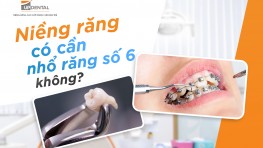 [Thắc mắc] Niềng răng nhổ răng số 6 có cần thiết không?